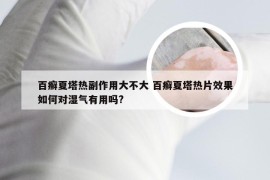 百癣夏塔热副作用大不大 百癣夏塔热片效果如何对湿气有用吗?