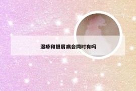 湿疹和银屑病会同时有吗