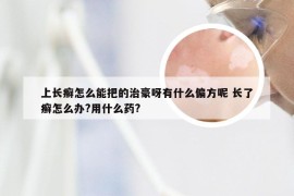 上长癣怎么能把的治豪呀有什么偏方呢 长了癣怎么办?用什么药?