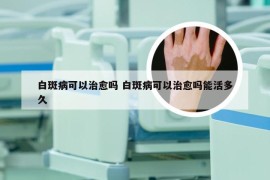 白斑病可以治愈吗 白斑病可以治愈吗能活多久