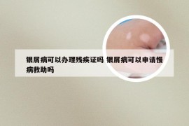 银屑病可以办理残疾证吗 银屑病可以申请慢病救助吗