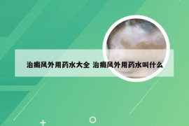 治癜风外用药水大全 治癜风外用药水叫什么