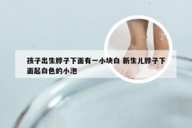 孩子出生脖子下面有一小块白 新生儿脖子下面起白色的小泡