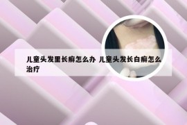 儿童头发里长癣怎么办 儿童头发长白癣怎么治疗