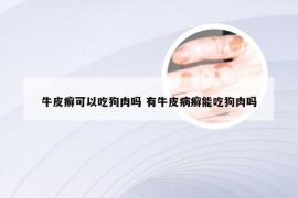 牛皮癣可以吃狗肉吗 有牛皮病癣能吃狗肉吗