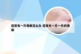 后背有一片像癣怎么办 后背长一片一片的像癣