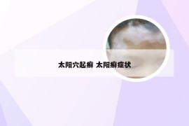 太阳穴起癣 太阳癣症状