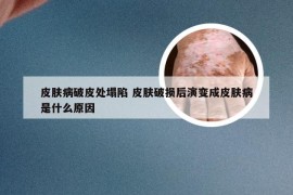 皮肤病破皮处塌陷 皮肤破损后演变成皮肤病是什么原因