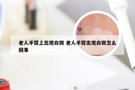 老人手臂上出现白斑 老人手臂出现白斑怎么回事