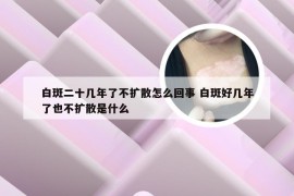 白斑二十几年了不扩散怎么回事 白斑好几年了也不扩散是什么