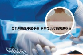 怎么判断是不是手癣 手癣怎么才能彻底根治