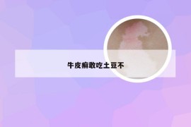 牛皮癣敢吃土豆不