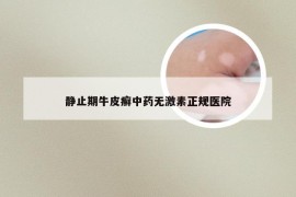 静止期牛皮癣中药无激素正规医院