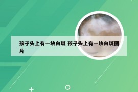 孩子头上有一块白斑 孩子头上有一块白斑图片