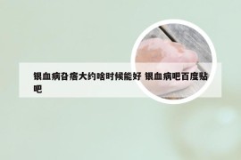 银血病旮瘩大约啥时候能好 银血病吧百度贴吧