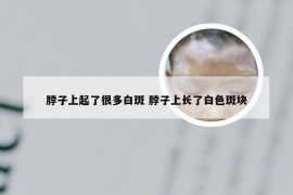 脖子上起了很多白斑 脖子上长了白色斑块