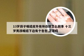 13岁孩子喉结皮外有块白斑怎么回事 十三岁男孩喉结下边有个包包,正常吗