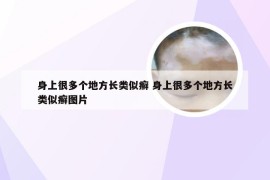 身上很多个地方长类似癣 身上很多个地方长类似癣图片