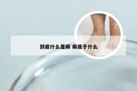 到底什么是癣 癣属于什么