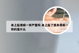 身上起像癣一样严重吗 身上起了很多像癣一样的是什么