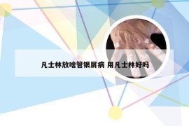 凡士林放啥管银屑病 用凡士林好吗