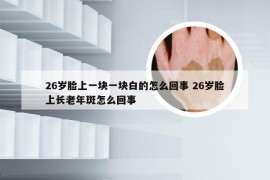 26岁脸上一块一块白的怎么回事 26岁脸上长老年斑怎么回事