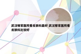 武汉哪家医院看皮肤科最好 武汉那家医院看皮肤科比较好