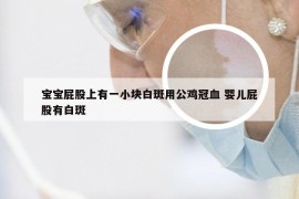 宝宝屁股上有一小块白斑用公鸡冠血 婴儿屁股有白斑