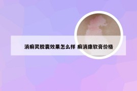 消癣灵胶囊效果怎么样 癣消康软膏价格