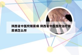 陕西省中医院银屑病 陕西省中医医院治疗银屑病怎么样