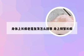 身体上长癣老是复发怎么回事 身上频繁长癣