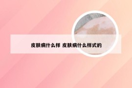 皮肤病什么样 皮肤病什么样式的