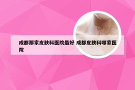 成都那家皮肤科医院最好 成都皮肤科哪家医院