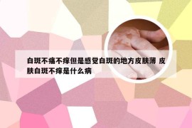 白斑不痛不痒但是感觉白斑的地方皮肤薄 皮肤白斑不痒是什么病