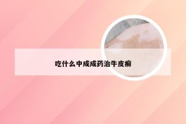 吃什么中成成药治牛皮癣