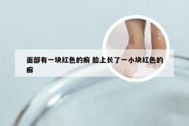 面部有一块红色的癣 脸上长了一小块红色的癣