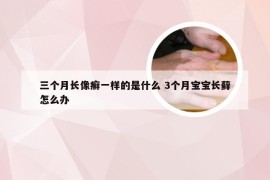 三个月长像癣一样的是什么 3个月宝宝长藓怎么办