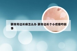 颧骨旁边长癣怎么办 颧骨边长个小疙瘩咋回事