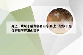 身上一块块干燥像癣也不痒 身上一块块干燥像癣也不痒怎么回事