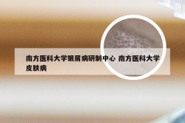 南方医科大学银屑病研制中心 南方医科大学皮肤病