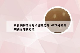 银屑病的根治方法健康之路 2020年银屑病的治疗新方法