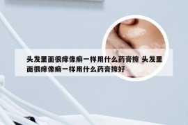 头发里面很痒像癣一样用什么药膏擦 头发里面很痒像癣一样用什么药膏擦好