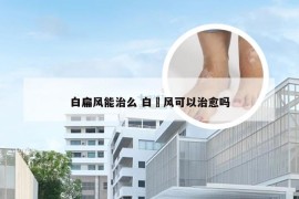 白扁风能治么 白瘨风可以治愈吗