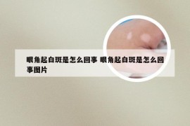 眼角起白斑是怎么回事 眼角起白斑是怎么回事图片