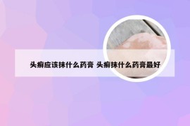 头癣应该抹什么药膏 头癣抹什么药膏最好