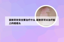 苗肤灵软膏主要治疗什么 苗肤灵可以治疗脸上的痘痘么