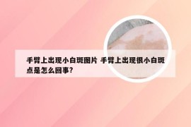 手臂上出现小白斑图片 手臂上出现很小白斑点是怎么回事?