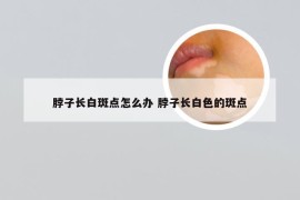 脖子长白斑点怎么办 脖子长白色的斑点