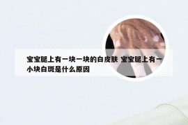 宝宝腿上有一块一块的白皮肤 宝宝腿上有一小块白斑是什么原因