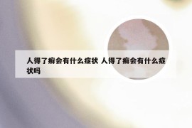 人得了癣会有什么症状 人得了癣会有什么症状吗